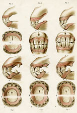 Age of Horse as indicated by the teeth